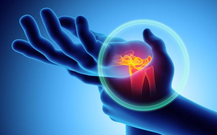 What Is Carpal Tunnel? Key Facts for Veterans